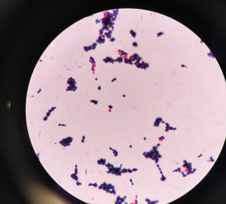 VšĮ Utenos ligoninės laboratorijoje atliekami mikrobiologiniai tyrimai