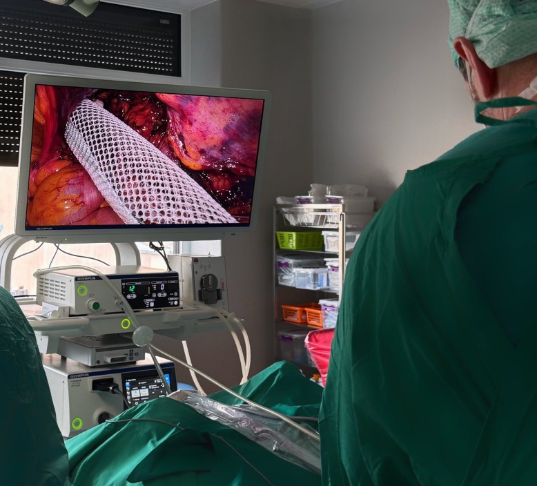 Apie šiuolaikinius chirurginio gydymo metodus pasakoja VšĮ Utenos ligoninės abdominalinis chirurgas Edgaras Kulikauskas